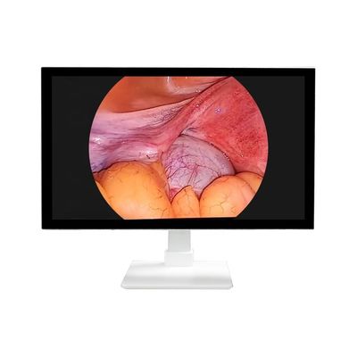 주문 TUYOU 4K 32' 의 의료 모든 일에서 딱딱한 내시경 카메라 시스템 온라인 제품