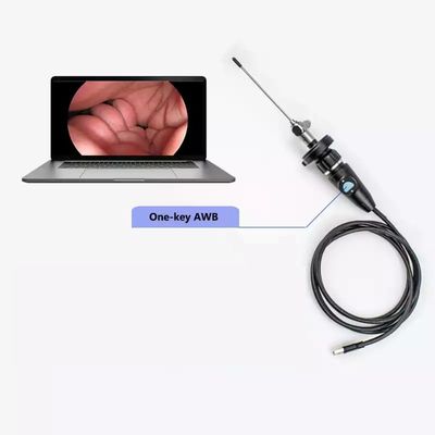 주문 전기 풀 HD CMOS 의료 휴대용 USB 엔도스코프 카메라 온라인 제품