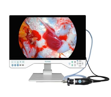 주문 휴대용 HD 엔도스코프 카메라와 광원을 갖춘 1인원 외과외과 카메라 시스템 온라인 제품