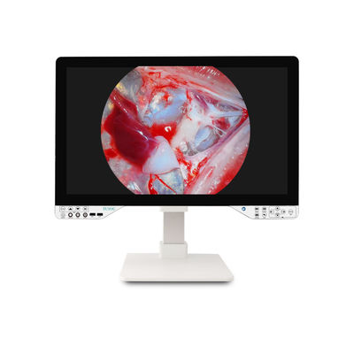 주문 27인치 의학적 전화 HD 내시경 카메라 여성과 수술용 광소와 모니터 온라인 제품