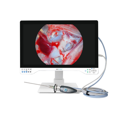 주문 32-inch 4K Medical Endoscope Camera with 8-Hour Battery Life 온라인 제품