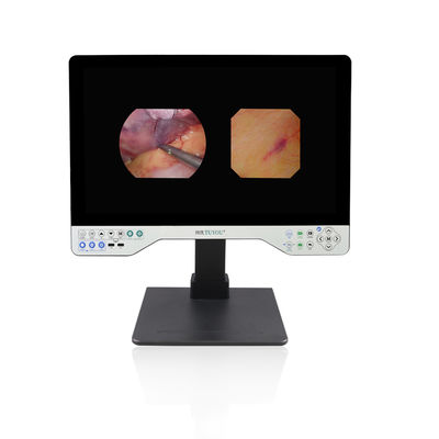 주문 OEM/ODM Factory Direct 24-Inch All-in-One Camera System with Rigid & Flexible Endoscope for ENT and Urological Surgery 온라인 제품
