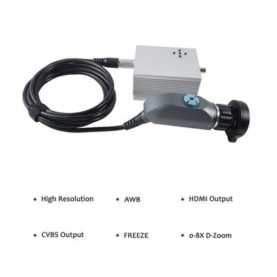 주문 FHD 1080P Portable Endoscope Camera System with 60fps and 1920x1080 Resolution for ENT Surgery and Pet Checking 온라인 제품