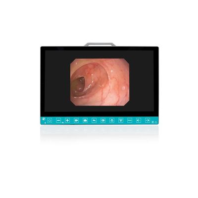 주문 TUYOU 13.3-Inch FHD Flexible Endoscope Camera System Multi-Color OEM Custom All-in-One Portable Uro-Gyn TikTok Hit 온라인 제품