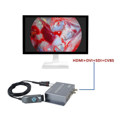 주문 TUYOU Manufacturer4-Output FHD Portable  Endoscopy Camera System  For ENT Checking 온라인 제품