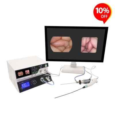 주문 TUYOU HD Endoscopy Camera System with ENT Bronchoscopy Checking and Laparoscopy Urology Applications Featuring Auto White Balance 온라인 제품