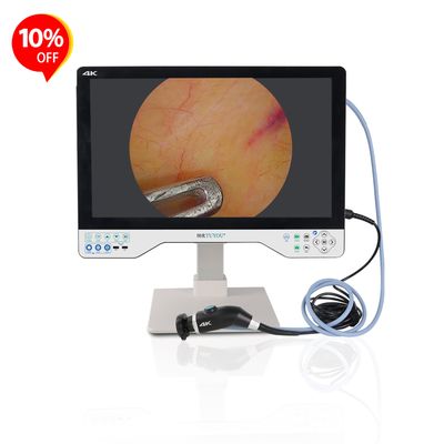 주문 All-in-one Camera System With 24 Inches Monitor For Laparoscopy ENT Surgery Manufacturer  온라인 제품