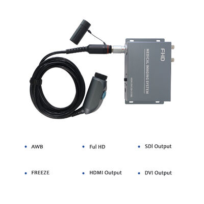 주문 Wireless Portable Endoscope Camera System - High Resolution for ENT/Orthopedics Clinical Examination 온라인 제품