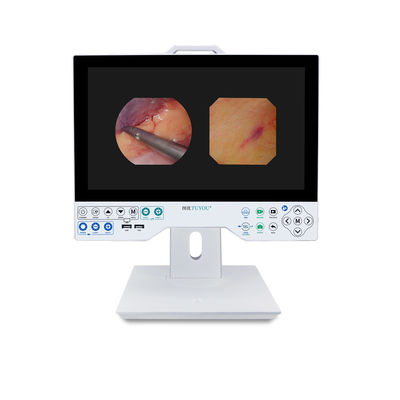 15인치 FHD 유연하고 딱딱한 내시경 카메라 시스템 재생 및 USB 저장 기능