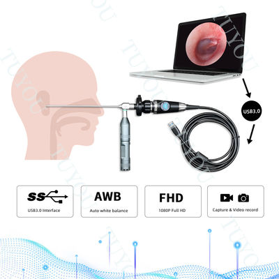 휴대용 USB3.0 내시경 손잡이 카메라 의료 외과 검사