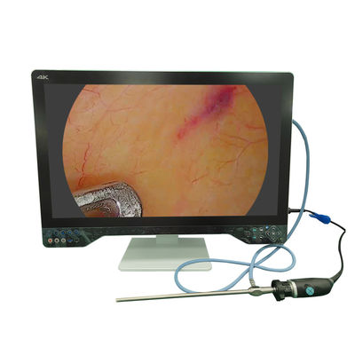 TUYOU 32인치 4K 의료용 이비인후과 내시경 카메라 시스템 (USB 복강경 기능, 광원 및 모니터 포함)