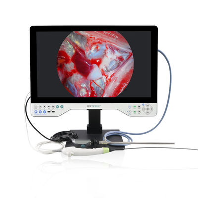 TUYOU Medical 1080P 24' 튼튼하고 유연한 모든 안드로스코프 카메라 시스템