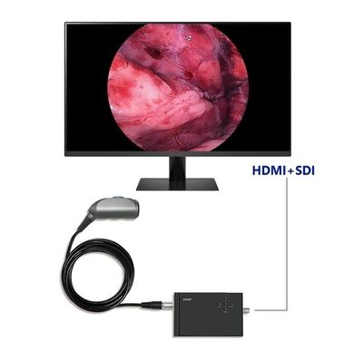 TUYOU 휴대용 내시경 비디오 카메라 풀 HD 1920x1080 해상도 120도 시야장 비뇨기술 척추 및 외과 수술