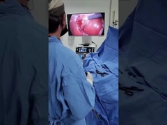 라파로스코피 및 LENT를 위한 차가운 광원으로 TU-LSD90TB 2인1 카메라 시스템