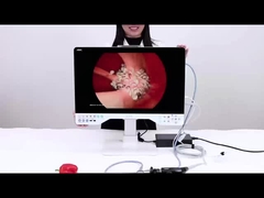 24인치 TUYOU 나소파린고스코프 내시경 카메라 레코더