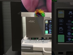 혈관 증강과 함께 4K 내시경 카메라 시스템